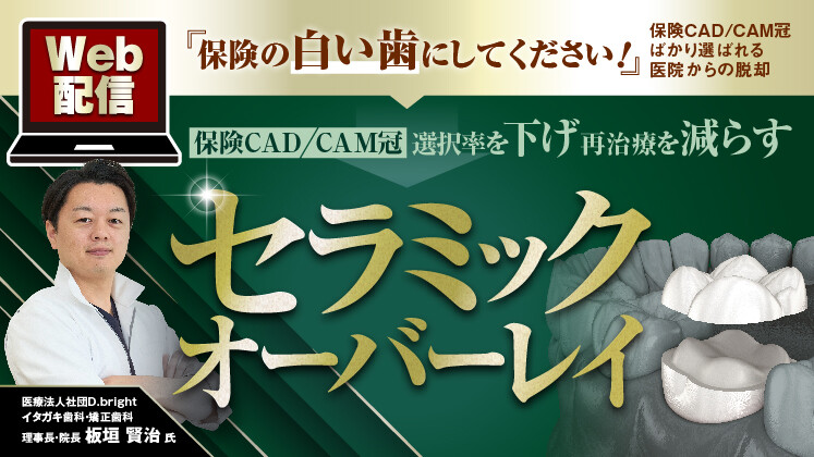 8割の患者が自費補綴を選ぶ【セラミックオーバーレイ】導入強化