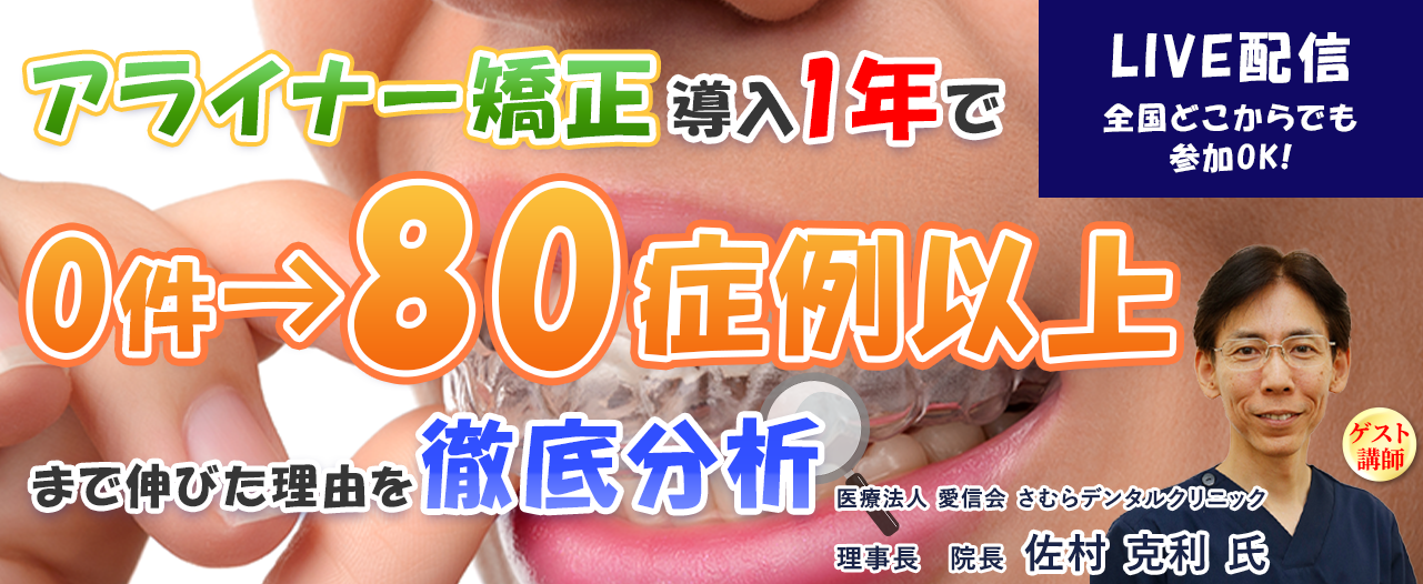 【webセミナー】アライナー矯正